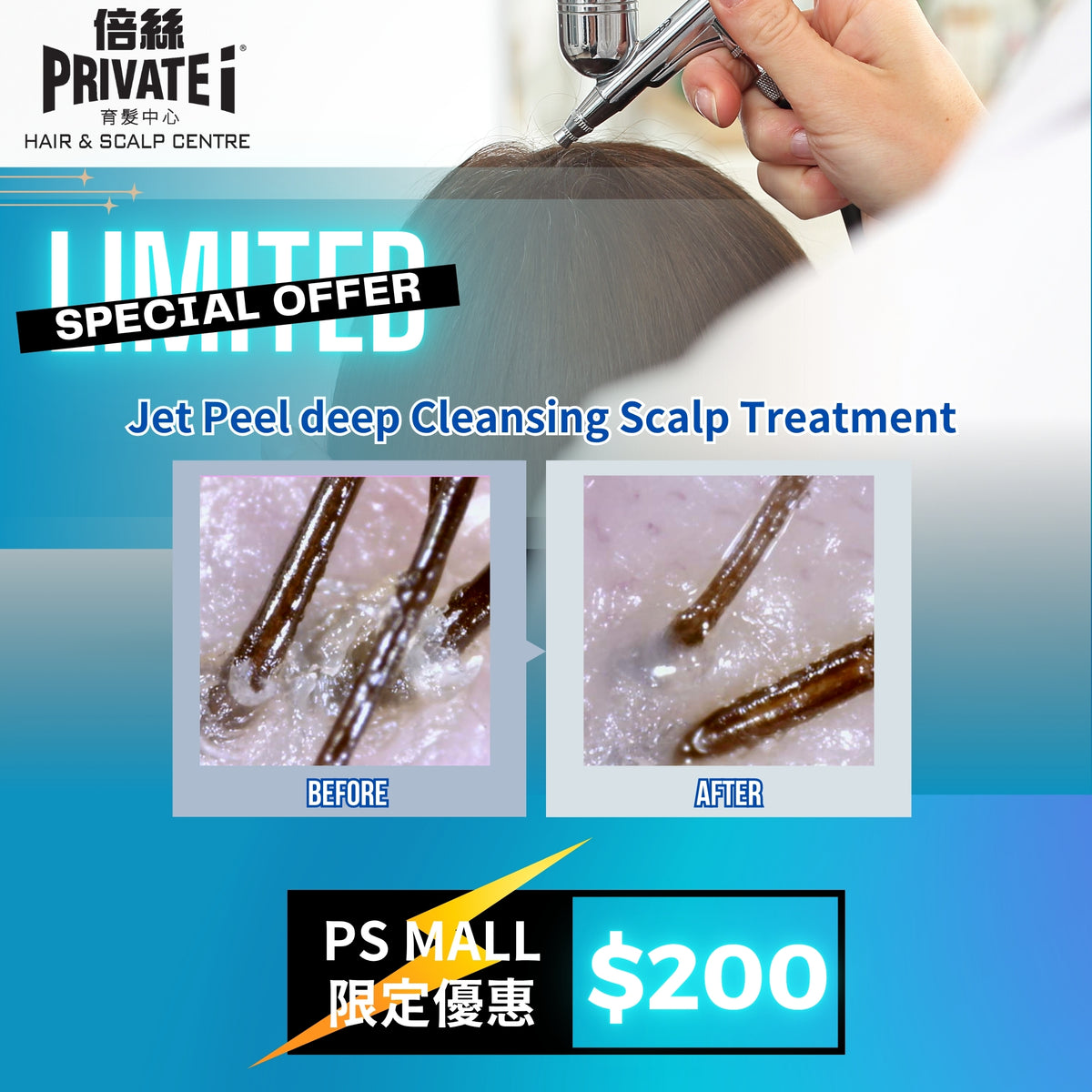 優惠價$200 享 【O2 Jet Plus活氧噴射頭皮潔淨療程】乙次 (原價$980)